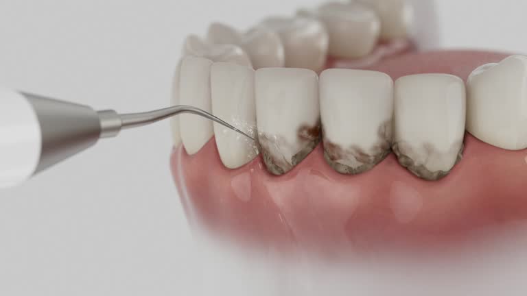Trusted Invisalign Clear Aligners service in Malvern, IA - Dentist Open Now